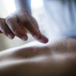 acupuncturist, minneapolis acupuncture, minneapolis community acupuncture